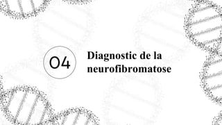 Diagnostic de la
neurofibromatose
04
 