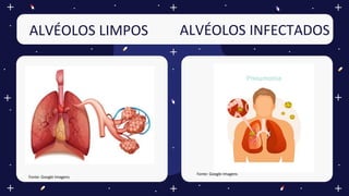 ALVÉOLOS LIMPOS ALVÉOLOS INFECTADOS
Fonte: Google Imagens
Fonte: Google Imagens
 