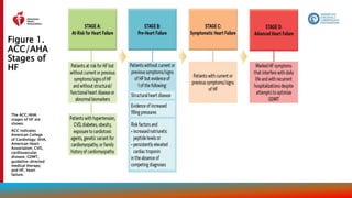 Figure 1.
ACC/AHA
Stages of
HF
20
The ACC/AHA
stages of HF are
shown.
ACC indicates
American College
of Cardiology; AHA,
American Heart
Association; CVD,
cardiovascular
disease; GDMT,
guideline-directed
medical therapy;
and HF, heart
failure.
 