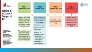 20
Figure 1.
ACC/AHA
Stages of
HF
The ACC/AHA
stages of HF are
shown.
ACC indicates
American College
of Cardiology; AHA,
American Heart
Association; CVD,
cardiovascular
disease; GDMT,
guideline-directed
medical therapy;
and HF, heart
failure.
 