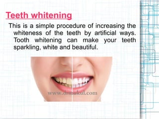 Teeth whitening 
This is a simple procedure of increasing the 
whiteness of the teeth by artificial ways. 
Tooth whitening can make your teeth 
sparkling, white and beautiful. 
 