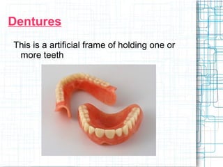 Dentures 
This is a artificial frame of holding one or 
more teeth 
 