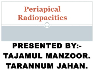 PRESENTED BY:-
TAJAMUL MANZOOR.
TARANNUM JAHAN.
Periapical
Radiopacities
 