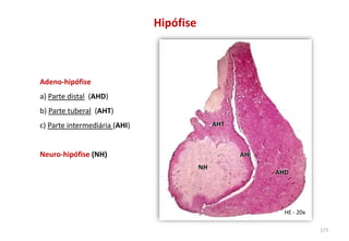 Adeno-hipófise
a) Parte distal (AHD)
b) Parte tuberal (AHT)
c) Parte intermediária (AHI)
Neuro-hipófise (NH)
HE - 20x
Hipófise
AHD
AHT
AHI
NH
AHI
177
 