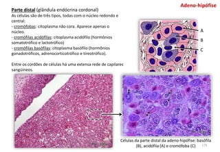 Células da parte distal da adeno-hipófise: basófila
(B), acidófila (A) e cromófoba (C)
Parte distal (glândula endócrina cordonal)
As células são de três tipos, todas com o núcleo redondo e
central:
- cromófobas: citoplasma não cora. Aparece apenas o
núcleo.
- cromófilas acidófilas: citoplasma acidófilo (hormônios
somatotrófico e lactotrófico)
- cromófilas basófilas: citoplasma basófilo (hormônios
gonadotróficos, adrenocorticotrófico e tireotrófico).
Entre os cordões de células há uma extensa rede de capilares
sangüíneos.
HE - 100x
HE - 400x
Adeno-hipófise
A
B
C
179
 