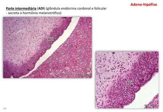 Parte intermediária (ADI) (glândula endócrina cordonal e folicular
- secreta o hormônio melanotrófico)
HE - 100x
HE - 400x
Adeno-hipófise
ADI
ADI
180
 