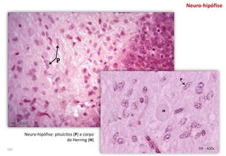 Neuro-hipófise
Neuro-hipófise: pituícitos (P) e corpo
de Herring (H)
HE - 400x
HE - 400x
P
183
 