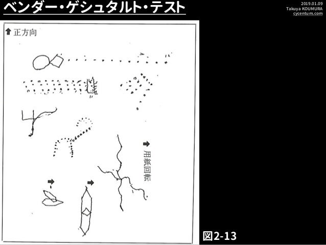 ベンダー・ゲシュタルト・テスト