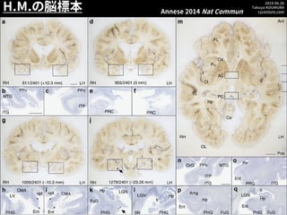 2019.06.26
Takuya KOUMURA
cycentum.com
H.M.の脳標本 Annese 2014 Nat Commun
 