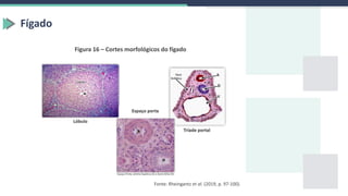 Fígado
Figura 16 – Cortes morfológicos do fígado
Fonte: Rheingantz et al. (2019, p. 97-100).
 