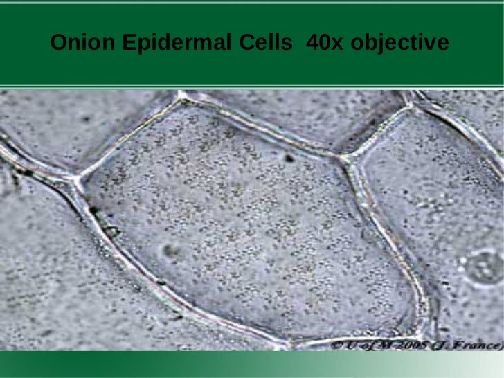 experiment to look at onion cells Look at the onion cells at low, medium, and high power observations: draw and label what you see low (4x) medium (10x) high (40x) onion skin lab:. experiment to look at onion cells Look at the onion cells at low, medium, and high power observations: draw and label what you see low (4x) medium (10x) high (40x) onion skin lab:.