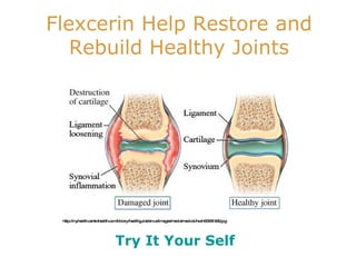 Try It Your Self http://myhealth.centrahealth.com/library/healthguide/en-us/images/media/medical/hw/n55551936.jpg Flexcerin Help Restore and  Rebuild Healthy Joints  