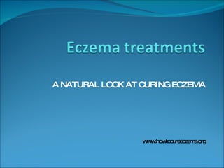 A  NATURAL  LOOK  AT  CURING  ECZEMA www.howtocureeczema.org 