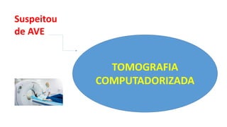 TOMOGRAFIA
COMPUTADORIZADA
Suspeitou
de AVE
 