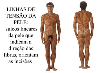 LINHAS DE
TENSÃO DA
PELE:
sulcos lineares
da pele que
indicam a
direção das
fibras, orientam
as incisões
 