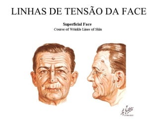 LINHAS DE TENSÃO DA FACE
 