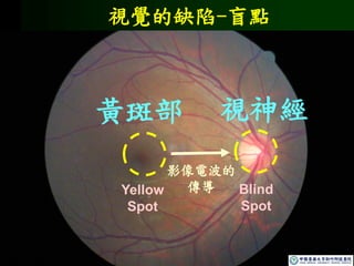 視神經
黃斑部
視覺的缺陷-盲點
影像電波的
傳導 Blind
Spot
Yellow
Spot
 