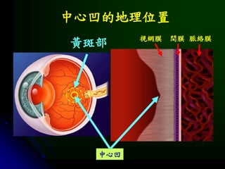 視網膜 脈絡膜
中心凹
間膜
黃斑部
中心凹的地理位置
 