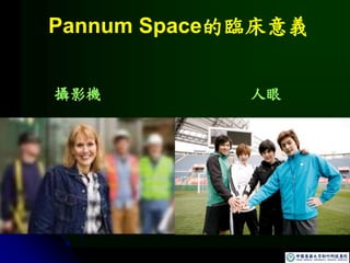 Pannum Space的臨床意義
攝影機 人眼
 