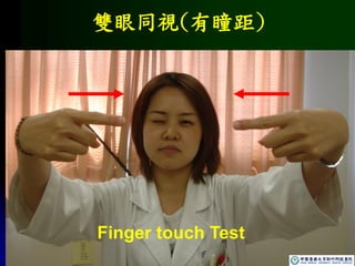 雙眼同視(有瞳距)
Finger touch Test
 