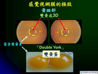 感覺視網膜的極致
「Double York」
富含葉黃素
雙黃蛋
雙黃成3D
黃斑部
 