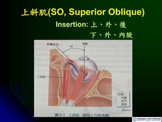 上斜肌(SO, Superior Oblique)
Insertion: 上、外、後
下、外、內旋
 