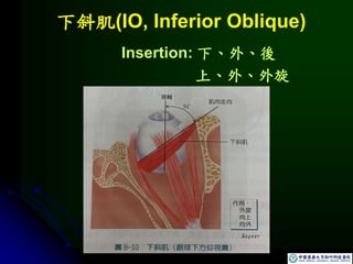 下斜肌(IO, Inferior Oblique)
Insertion: 下、外、後
上、外、外旋
 