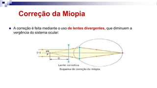 Correção da Miopia
◼ A correção é feita mediante o uso de lentes divergentes, que diminuem a
vergência do sistema ocular:
 