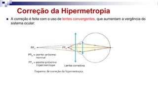 Correção da Hipermetropia
◼ A correção é feita com o uso de lentes convergentes, que aumentam a vergência do
sistema ocular:
 