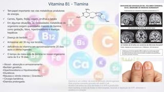 Vitamina B1 - Tiamina
 Tem papel importante nas vias metabólicas produtoras
de energia.
 Carnes, fígado, feijão, vagem, ervilhas e batata
 Em algumas situações, as necessidades metabólicas do
organismo exigem quantidades maiores de tiamina,
como gestação, febre, hipertireoidismo e doenças
hepáticas
 Doença de beribéri
 Armazenar até 30 mg nos tecidos.
 deficiência da vitamina em aproximadamente 20 dias
após a última ingestão.
 O tempo de meia-vida da tiamina no nosso organismo
varia de 9 a 18 dias.
• Álcool - absorção e armazenamento .
•Beribéri genético.
•Hipertireoidismo e Hipotireoidismo.
•Diuréticos;
•Náusea e vômito intenso ( Gravidez).
• Cirurgia bariátrica.
•Diarreia prolongada. •tiamina é um cofator da enzima piruvato desidrogenase
•Esta enzima converte piruvato em acetil-CoA
•Acetil-CoA entra no ciclo de Krebs e o ATP é produzido
•Sem tiamina, o ciclo de Krebs é interrompido, levando à depleção de ATP, afetando o
cérebro e o coração
 