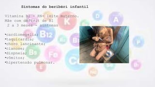 Sintomas do beribéri infantil
Vitamina B1 - RN- leite materno.
Mãe com déficit de B1
2 a 3 meses - sintomas
•cardiomegalia;
•taquicardia;
•choro lancinante;
•cianose;
•dispneia;
•vômitos;
•hipertensão pulmonar.
 