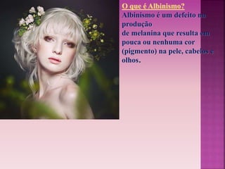 O que é Albinismo? 
Albinismo é um defeito na 
produção 
de melanina que resulta em 
pouca ou nenhuma cor 
(pigmento) na pele, cabelos e 
olhos. 
 