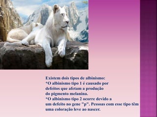 Existem dois tipos de albinismo: 
*O albinismo tipo 1 é causado por 
defeitos que afetam a produção 
do pigmento melanina. 
*O albinismo tipo 2 ocorre devido a 
um defeito no gene "p". Pessoas com esse tipo têm 
uma coloração leve ao nascer. 
 