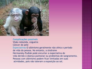 Complicações possíveis 
Visão reduzida, cegueira 
Câncer de pele 
Expectativas:O albinismo geralmente não afeta o período 
de vida da pessoa. No entanto, a síndrome 
Hermansky-Pudlak pode encurtar a expectativa de 
vida devido à doença pulmonar ou problemas de sangramento. 
Pessoas com albinismo podem ficar limitadas em suas 
atividades, pois não toleram a exposição ao sol. 
 