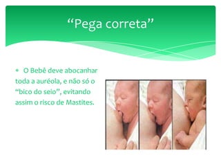 “Pega correta”
O Bebê deve abocanhar
toda a auréola, e não só o
“bico do seio”, evitando
assim o risco de Mastites.
 