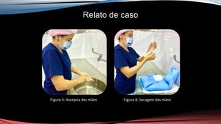 Relato de caso
Figura 3: Assepsia das mãos Figura 4: Secagem das mãos
 