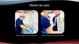 Relato de caso
ur
Figura 5: Abertura do kit Cirúrgico Figura 6: Vestindo o avental círúrgico
 