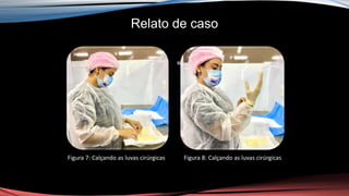Relato de caso
ur
Figura 7: Calçando as luvas cirúrgicas Figura 8: Calçando as luvas cirúrgicas
 