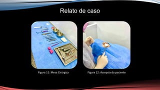 Relato de caso
Figura 11: Mesa Cirúrgica Figura 12: Assepsia do paciente
 