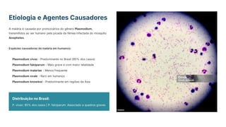 Etiologia e Agentes Causadores
A malária é causada por protozoários do gênero Plasmodium,
transmitidos ao ser humano pela picada da fêmea infectada do mosquito
Anopheles.
Espécies causadoras de malária em humanos:
Plasmodium vivax - Predominante no Brasil (85% dos casos)
Plasmodium falciparum - Mais grave e com maior letalidade
Plasmodium malariae - Menos frequente
Plasmodium ovale - Raro em humanos
Plasmodium knowlesi - Predominante em regiões da Ásia
Distribuição no Brasil:
P. vivax: 85% dos casos | P. falciparum: Associado a quadros graves
 