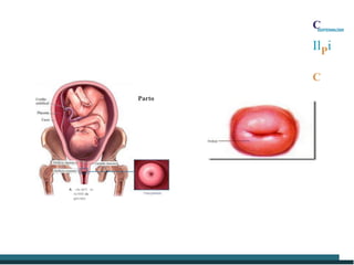 Parto
A. ·oto do11 ro
l1iO filllll da
grnv1dcz
C
IlPi
C
ENFERMAGEM
 