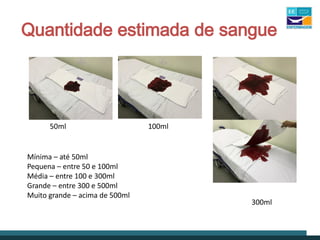 Quantidade estimada de sangue
Mínima – até 50ml
Pequena – entre 50 e 100ml
Média – entre 100 e 300ml
Grande – entre 300 e 500ml
Muito grande – acima de 500ml
50ml 100ml
300ml
 