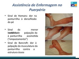 Assistência de Enfermagem no
Puerpério
• Sinal de Homans: dor na
panturrilha à dorsoflexão
do pé
• Sinal da
bandeira:
menor
mobilidade
à panturrilha
palpação da
acometida
(“empastamento”)
• Sinal de Bancroft: dor à
palpação da musculatura da
panturrilha contra a
estrutura óssea
 