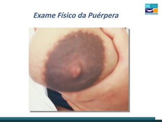 Exame Físico da Puérpera
 