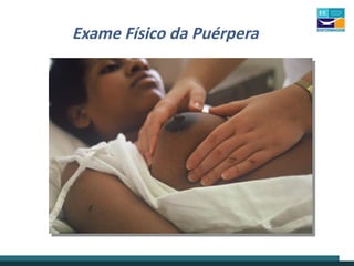 Exame Físico da Puérpera
 