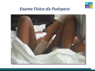 Exame Físico da Puérpera
 
