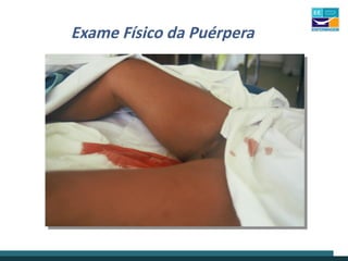 Exame Físico da Puérpera
 
