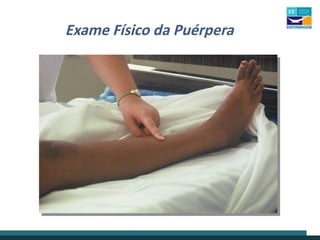 Exame Físico da Puérpera
 
