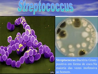 Streptococcus: Bactéria Gram-positiva em forma de coco.Na maioria das vezes inofensiva ao homem.  Streptococcus 