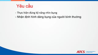 Yêu cầu
- Thực hiện đúng kỹ năng nhìn bụng
- Nhận định hình dáng bụng của người bình thường
 